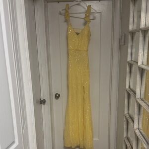 Windsor Golden Yellow Dress with Lace Detail